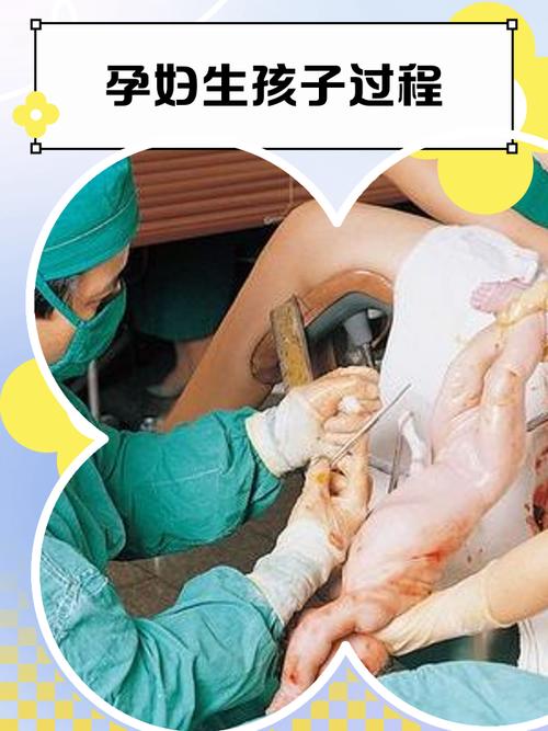 怀孕妇生孩子