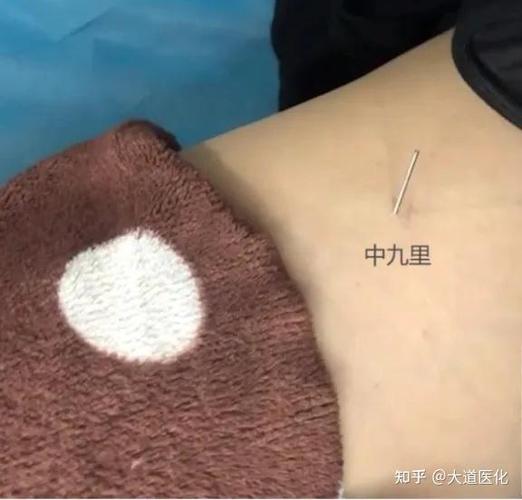 宝芝林治耳鸣是真是假