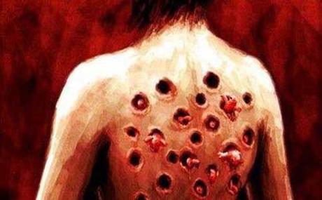 人体长虫子视频