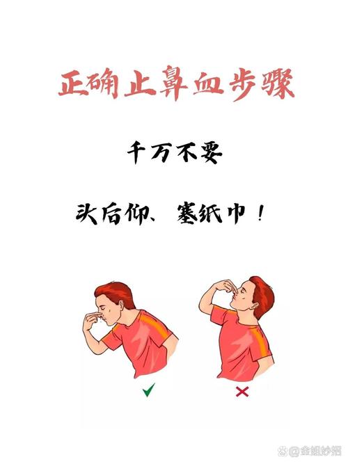 如何有效止住鼻血