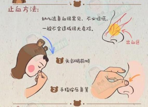 如何有效止住鼻血截图2