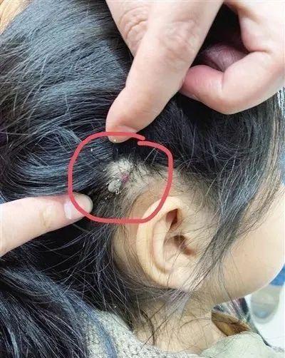 头部钻出虫子的少年