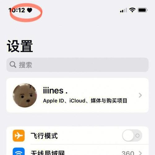 IOS15小组件