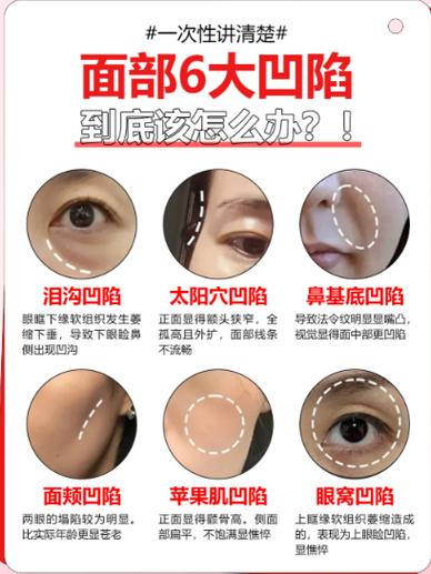脸部凹陷怎么恢复