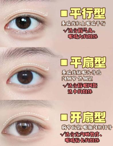 为什么内双变成了外双