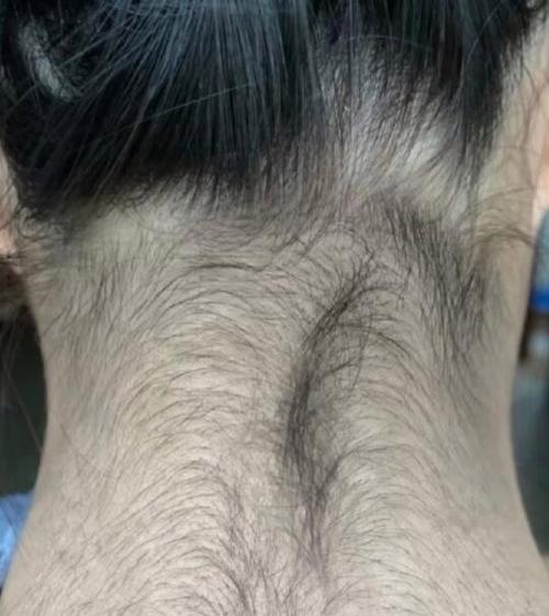 了毛是什么意思