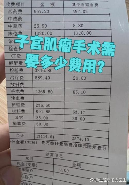 子宫肌瘤手术要多少钱