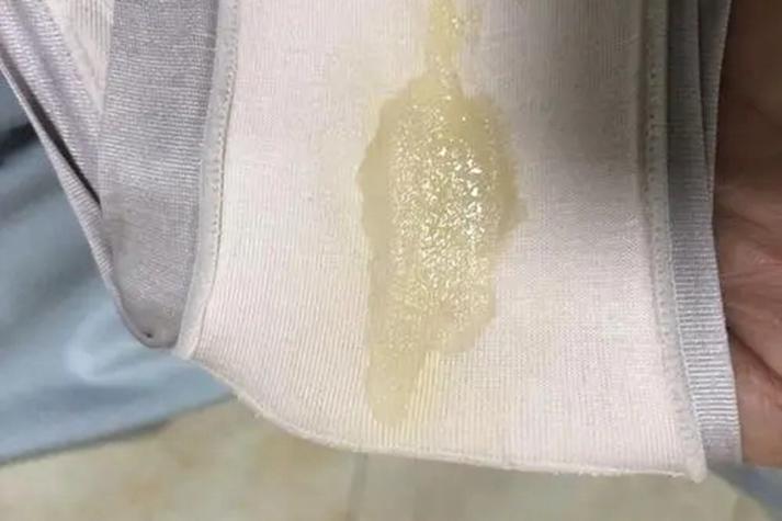 内裤上有一坨白色的粘稠物截图2