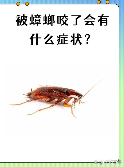 被蟑螂咬了怎么办?