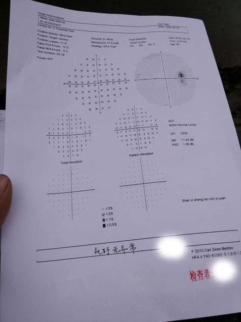 视野检查结果图怎么看