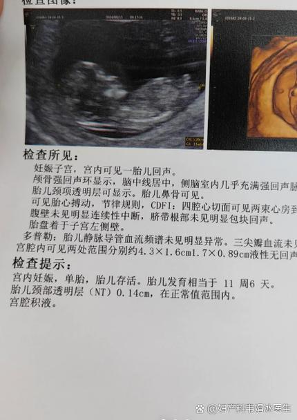 nt值2.4mm临界点怎么办