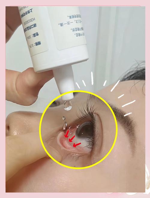 面膜精华弄到眼睛里怎么办