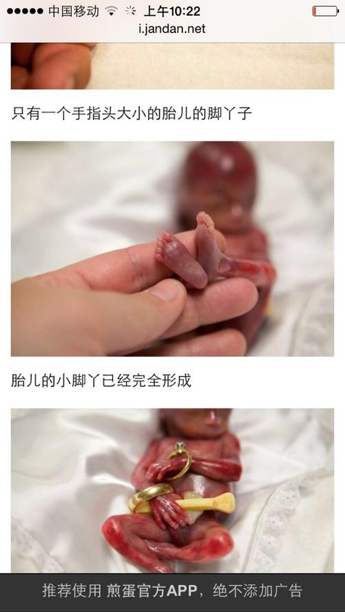 十五周胎儿图片