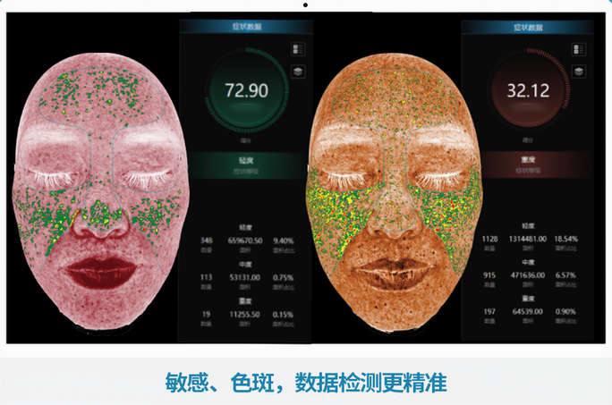 面部检测仪器截图3