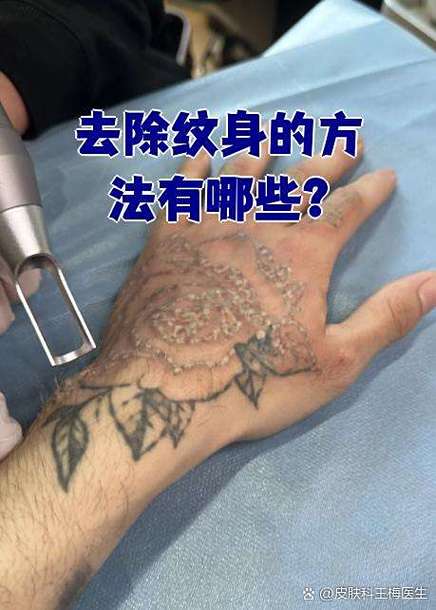 纹身怎么洗掉最快方法
