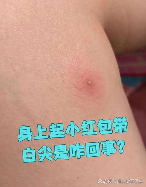 皮肤对称起红包