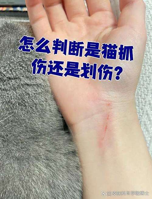 怎么区分猫抓伤还是划伤