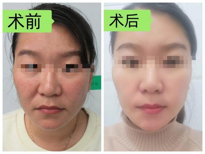 皮肤看起来特别显老怎么办