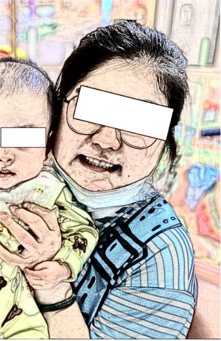 库欣病术后恢复截图3