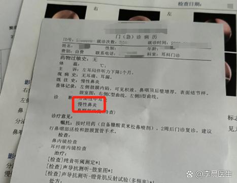 儿童流鼻血有粘稠状物体排出