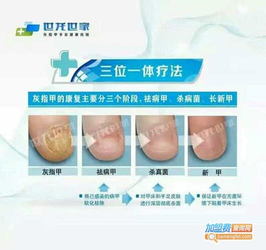 灰指甲广告