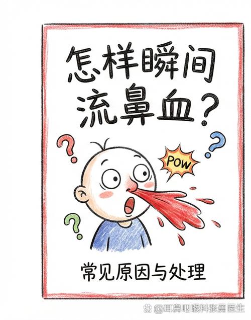 怎样才可以使自己快速流鼻血