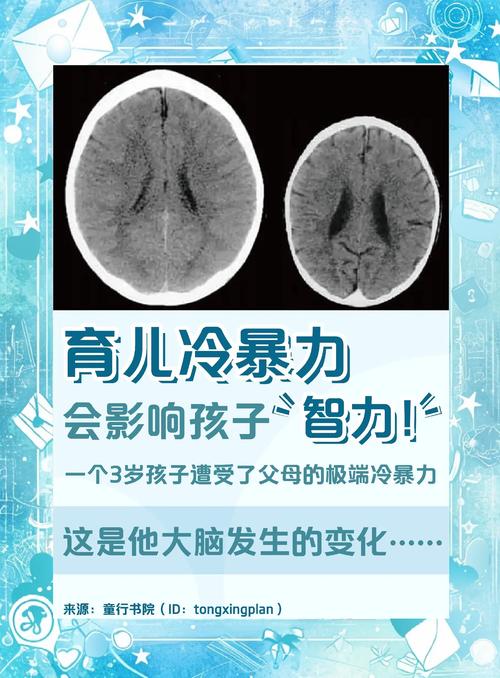 破坏欲强的孩子智商