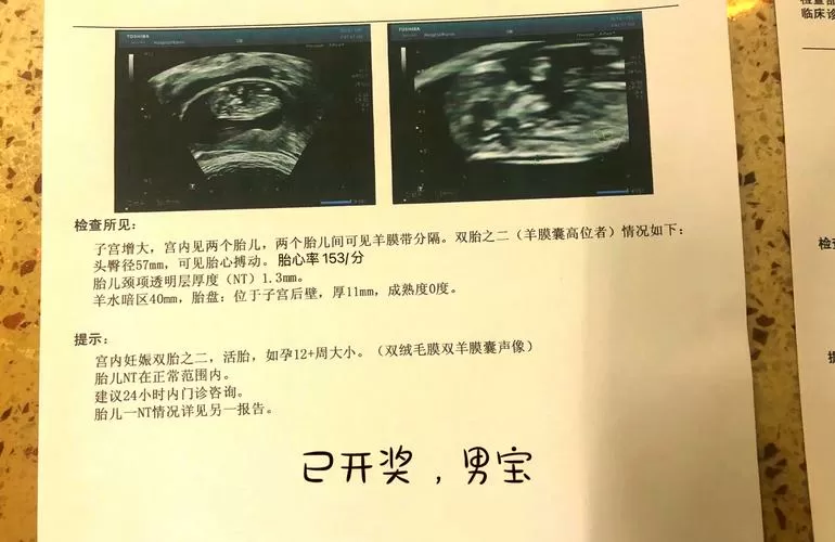 nt值看男女准确率高吗