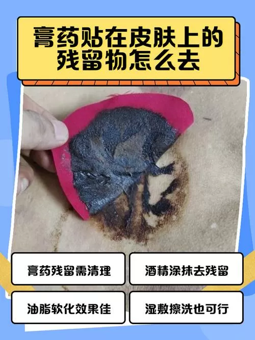 沾到身上的膏药怎么去掉